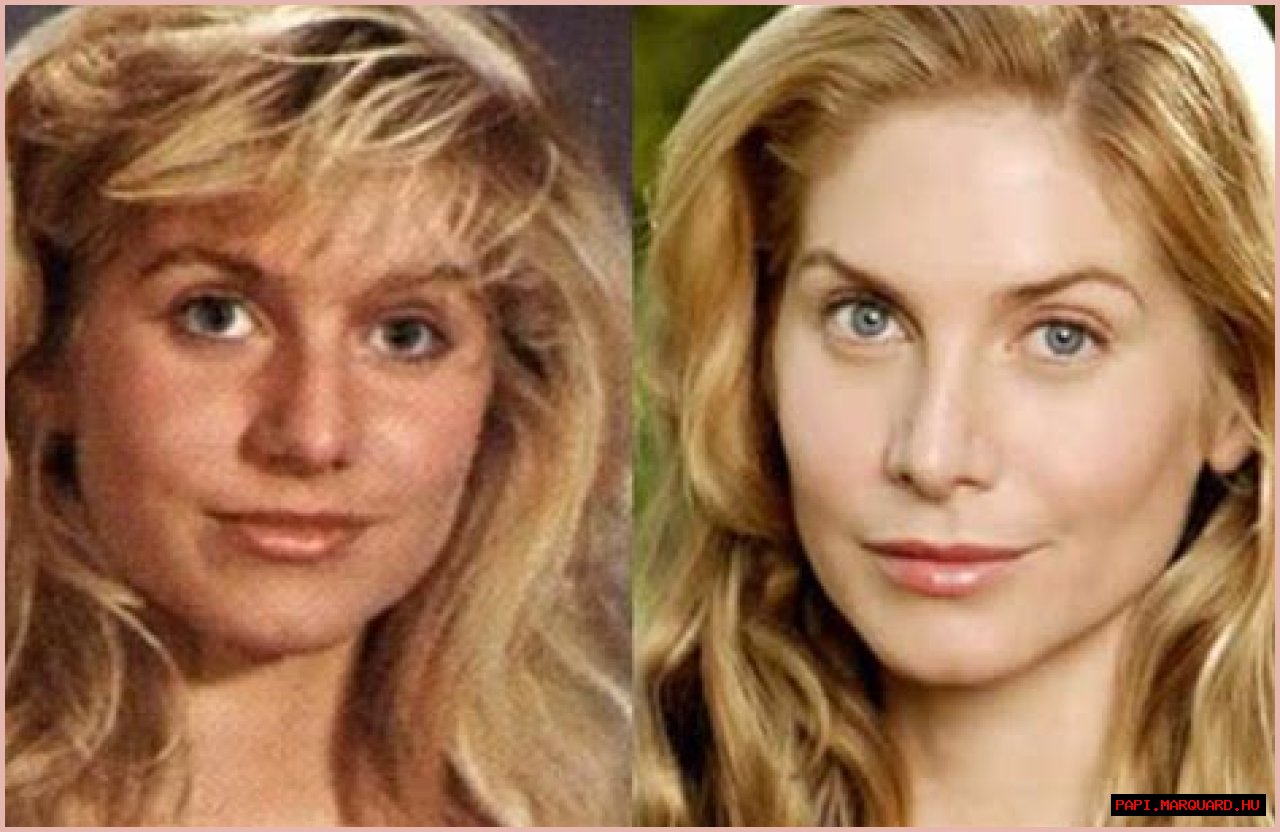 Elizabeth Mitchell Plastic Surgery Before and After