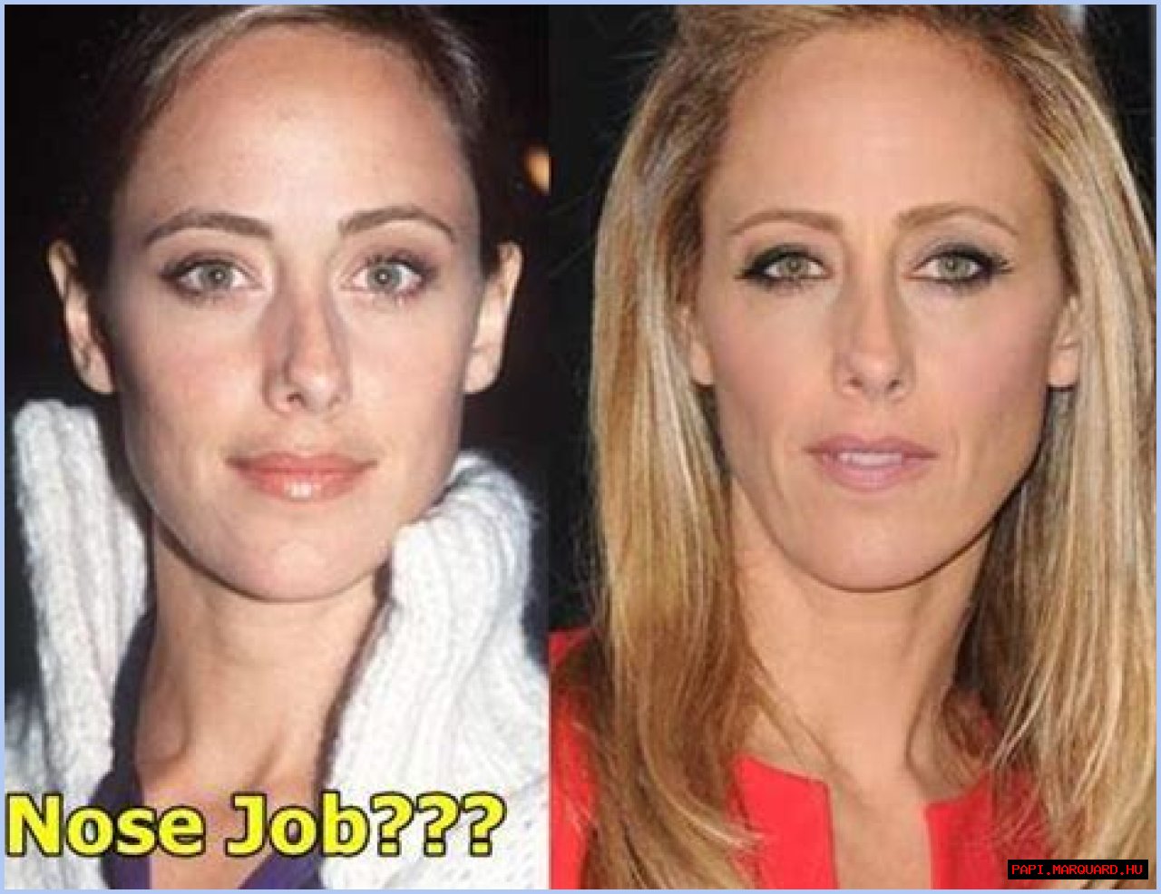 Kim Raver Plastic Surgery Before and After
