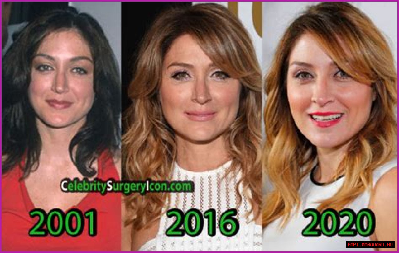 Sasha Alexander Plastic Surgery Before and After
